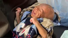 सोमालिया का एक बच्चा