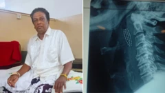 గొంతు, వస్తువులు, టూత్ బ్రష్, పళ్లు, శ్రీలంక