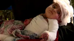 AFGHANISTAN HOSPITAL