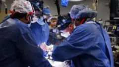 surgeons performing the surgery