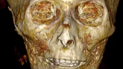 CT scan showing the skull of Amenhotep I