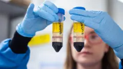 Scientist working on the vaccine