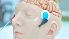 貼附有電極的大腦模型