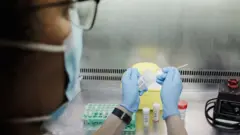 Maymun çiçeği testi yapılmaya başlandı.