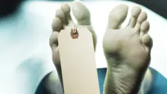 মরদেহের সাথে যৌন সম্পর্ক স্থাপন করা এক ধরণের যৌন ব্যাধি, যাকে ইংরেজিতে 'নেক্রোফিলিয়া' বলা হয়