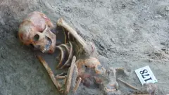 යාපනය, චෙම්මනි සිත්තුපාත්තු සුසාන භූමිය ආසන්නයේ සිදු කෙරෙන කැණීම්වලින් හමු වූ අස්ථි කොටස්