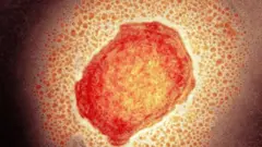 Ifoto igaragaza igice cya virusi ya Monkeypox 