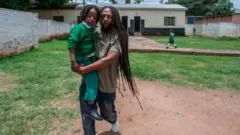 Abana bafite ibisage ubu bazajya bemerwa mu mashuri ya leta muri Malawi
