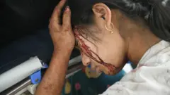 မတ်လ ၂၈ ရက်မှာ ငလျင်လှုပ်ပြီးတဲ့နောက် ဒဏ်ရာရသူ အမျိုးသမီးငယ်တစ်ဦးကို မြင်တွေ့ရတာဖြစ်ပါတယ်။ 