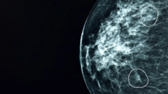 Imagem de mamograma com 2 pontos circulados 