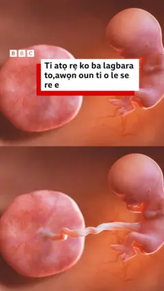 Alaye nipa atọ ọkunrin