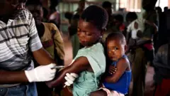 ኩፍኝ ዲሞክራቲክ ኮንጎ ውስጥ '2700 ህፋናትን ገደለ'