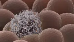 Célula cancerígena