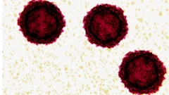 polio
