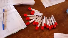 HIV test kits