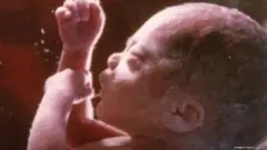 pregnancy