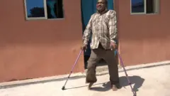 Nwoke nwere nkwarụ gara mahadum mụta ka esi agba ọkpụkpụ