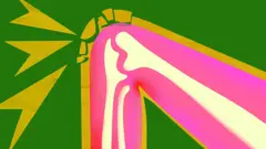 Схематичний малюнок коліна