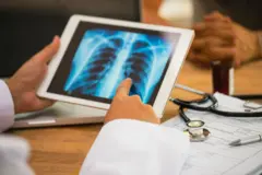 Mão de médico segurando tablet que mostra exame de imagem do pulmão em consultório