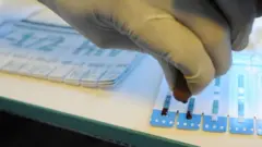 Ẹni to n ṣe ayẹwo ẹjẹ fun HIV