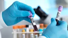 prueba de sangre