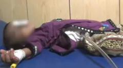 Bébé Shazia allongée sur un lit avec un tube sortant de son estomac - son visage est flouté pour dissimuler son identité.