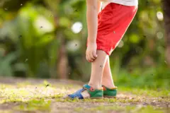  Mosquito on kids skin. Little boy attacked by mosquitoes in tropical forest. Insect repellent. Malaria and dengue fever prevention. Child scratching itchy bite in summer park.