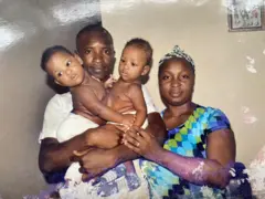 Conjoined twins: Etu anyị ji zọta ndụ ụmụejima anyị jikọrọ ọnụ