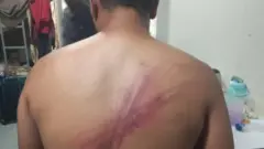 “කන්න දීලා තිබුනේ කේක් කෑල්ලකුයි, බිත්තරේකුයි විතරයි. මට බඩගිනි මමා ඔයාට දුක හිතෙන්නේ නැද්ද කියලා ඇහුවා. මම මොනවා කරන්න ද?” ඒ, මියන්මාරයේ සයිබර් වහල් කඳවුරක සේවයේ යෙදෙන්නට බල කෙරී ඇති 34 හැවිරිදි දියණියකගේ මවක්, බීබීසි සිංහල සේවයට කී කතාව ය.