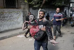 شابٌ يحمل طفلة مصابة ويركض في أحد شوارع غزة