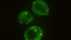 'இந்தப் பூஞ்சை செவ்வாய் கோளில்கூட சாகாது' - விஞ்ஞானிகளை வியக்க வைத்த கண்டுபிடிப்பு