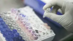 ডিএনএ নমুনা সংগ্রহের কাজ চলছে। ফাইল ছবি