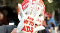 ఎయిడ్స్