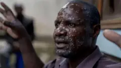 Aworan ẹni ti Mpox mu.