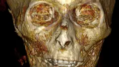 CT scan showing the scull of Amenhotep I