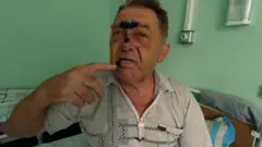"Намагалися зґвалтувати кийком": лікарі і пацієнти розповідають про дії силовиків у Білорусі
