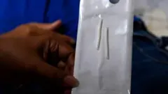 የእርግዝና መከላከያ