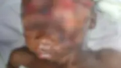 Daa'ima fuulli waraabeessaan ciniiname