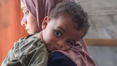 والدة أول مصاب بشلل الأطفال في غزة تعبر عن حزنها وسط حملة تطعيم أممية