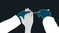 فحص الأجسام المضادة