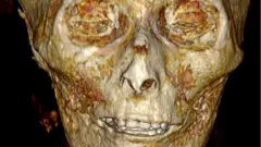 Una tomografía muestra la calavera de Amenhotep I