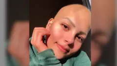 "أنت جميلة حتى بدون شعر"