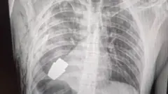 TH