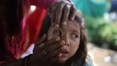 ਆਈ ਫਲੂ
