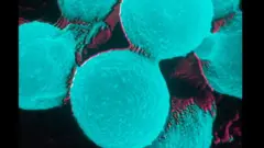 O fungo Cryptococcus