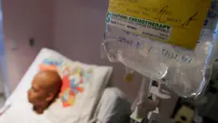 হাসপাতালে ক্যান্সার প্রতিকারে কেমোথেরাপি নিচ্ছেন একজন