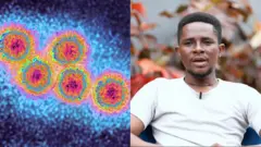 Aworan arakunrin kan to ni aisan Jẹdọjẹdọ.