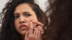 முகப்பரு ஏன் வருகிறது?