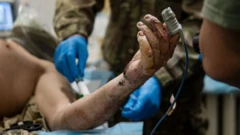 Рука раненого