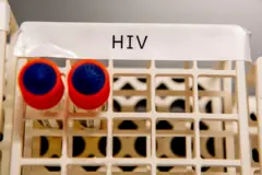 hiv